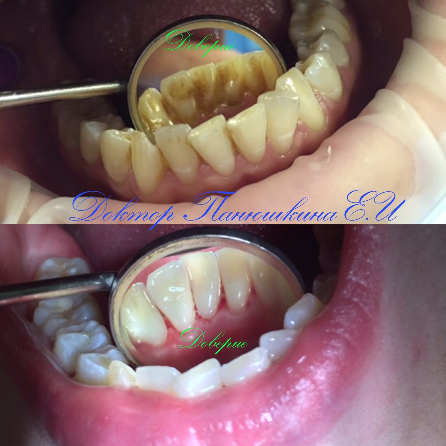 Комплексная чистка зубов&nbsp;Современная стоматология "ДОВЕРИЕ" : 