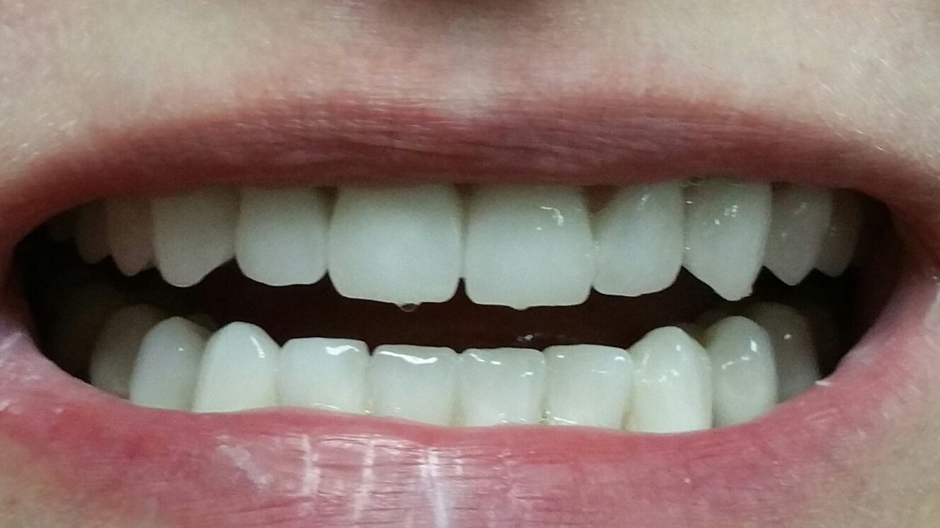 Работы нашей клиники&nbsp;Современная стоматология "ДОВЕРИЕ" : 