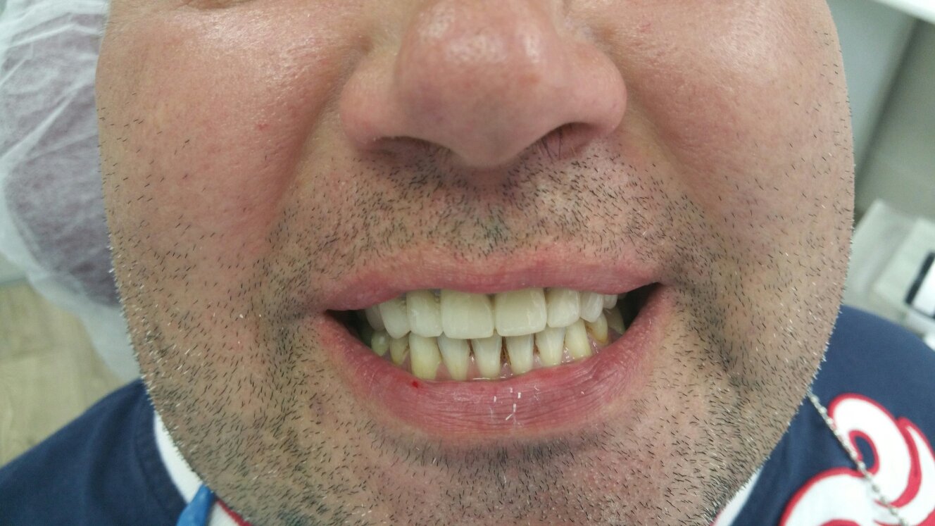 Работы нашей клиники&nbsp;Современная стоматология "ДОВЕРИЕ" : 