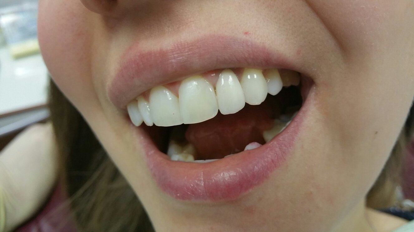 Работы нашей клиники&nbsp;Современная стоматология "ДОВЕРИЕ" : 