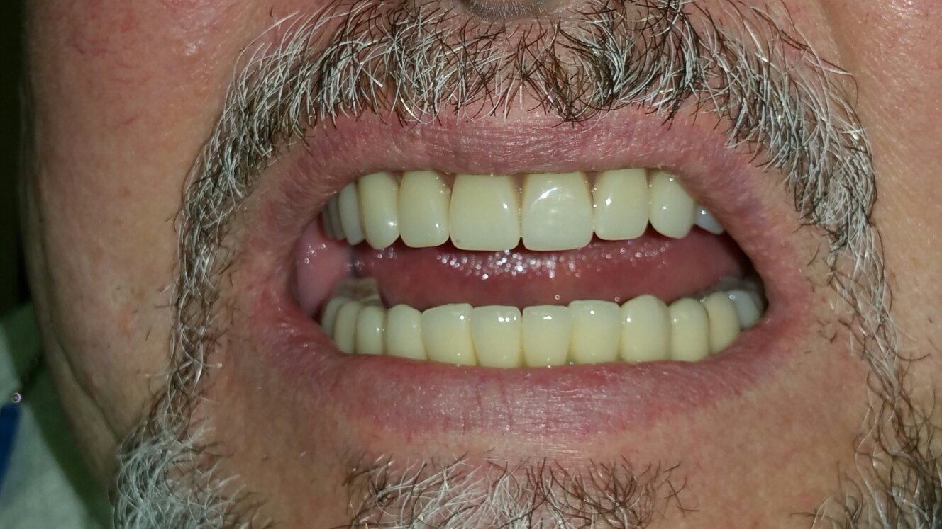 Работы нашей клиники&nbsp;Современная стоматология "ДОВЕРИЕ" : 