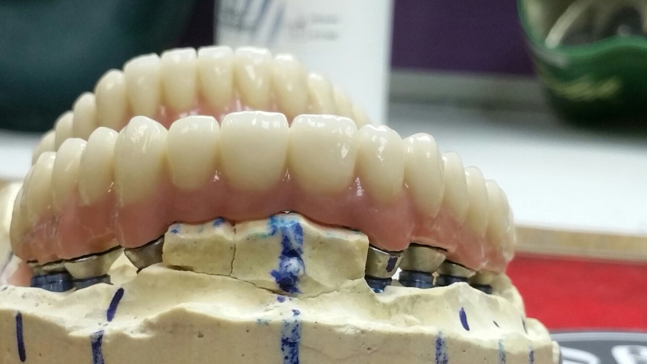 Работы нашей клиники&nbsp;Современная стоматология "ДОВЕРИЕ" : 