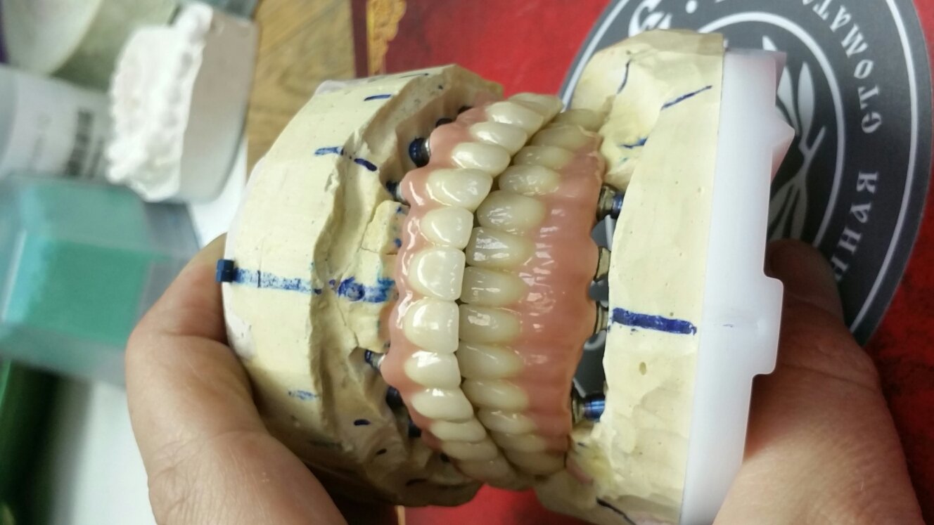 Работы нашей клиники&nbsp;Современная стоматология "ДОВЕРИЕ" : 