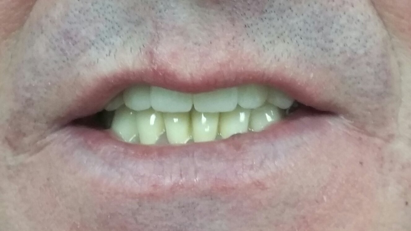 Работы нашей клиники&nbsp;Современная стоматология "ДОВЕРИЕ" : 