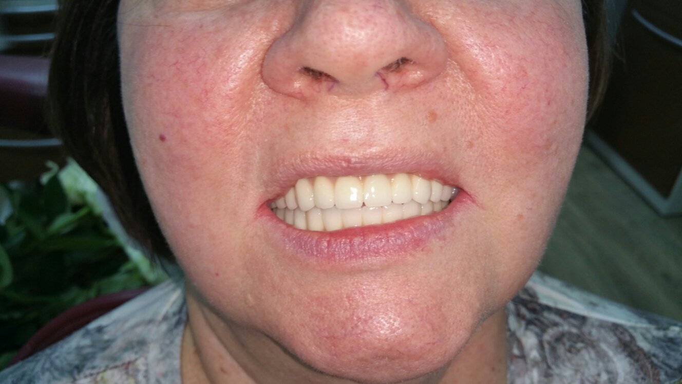 Работы нашей клиники&nbsp;Современная стоматология "ДОВЕРИЕ" : 